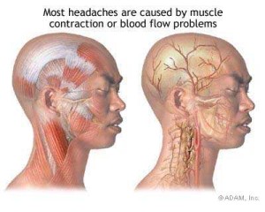 Muscle tension is more common in headaches and blood flow issues are more common in migraines.